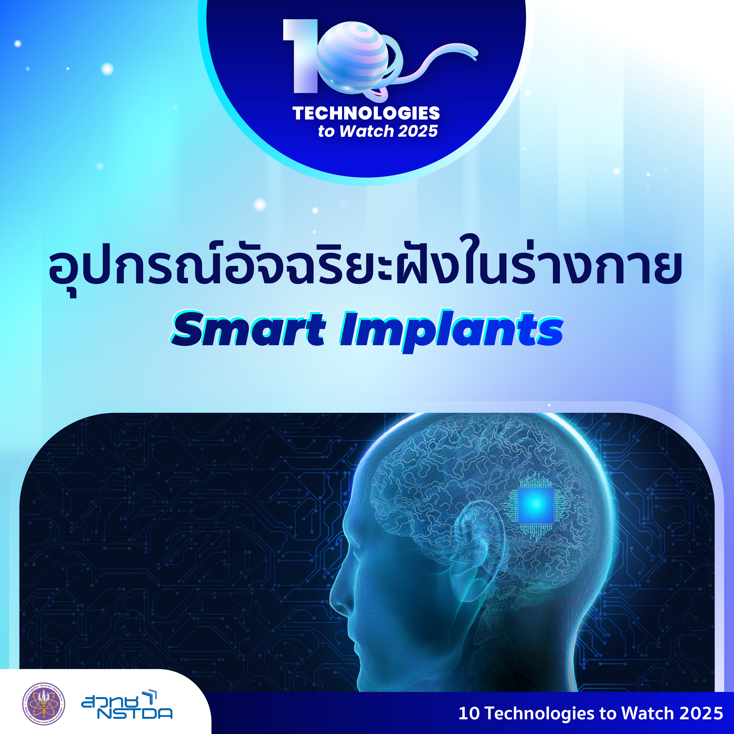 10 Technologies to Watch 2025: อุปกรณ์อัจฉริยะฝังในร่างกาย (Smart Implants)