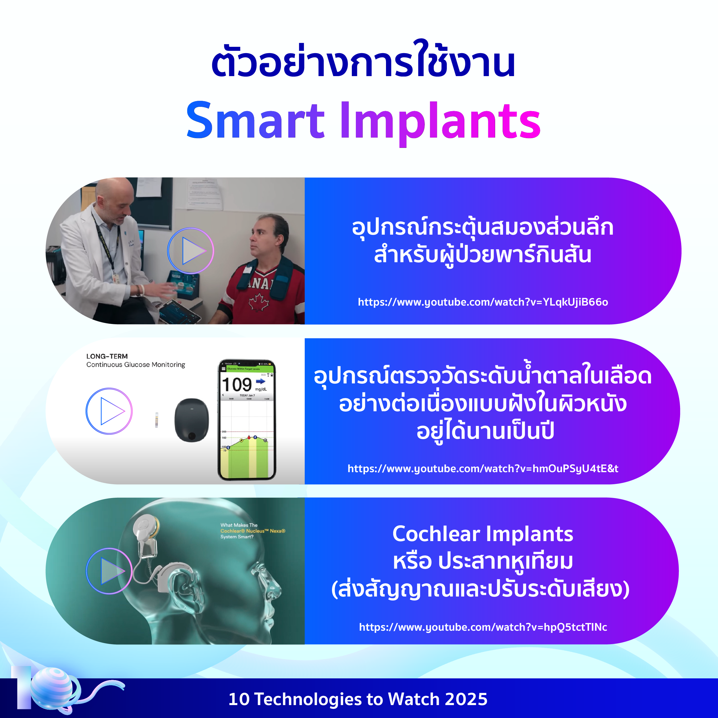 อินโฟกราฟิกประกอบเนื้อหาเรื่องอุปกรณ์อัจฉริยะฝังในร่างกาย โดยมีรายละเอียดอยู่ในเนื้อหาส่วนต่อไป