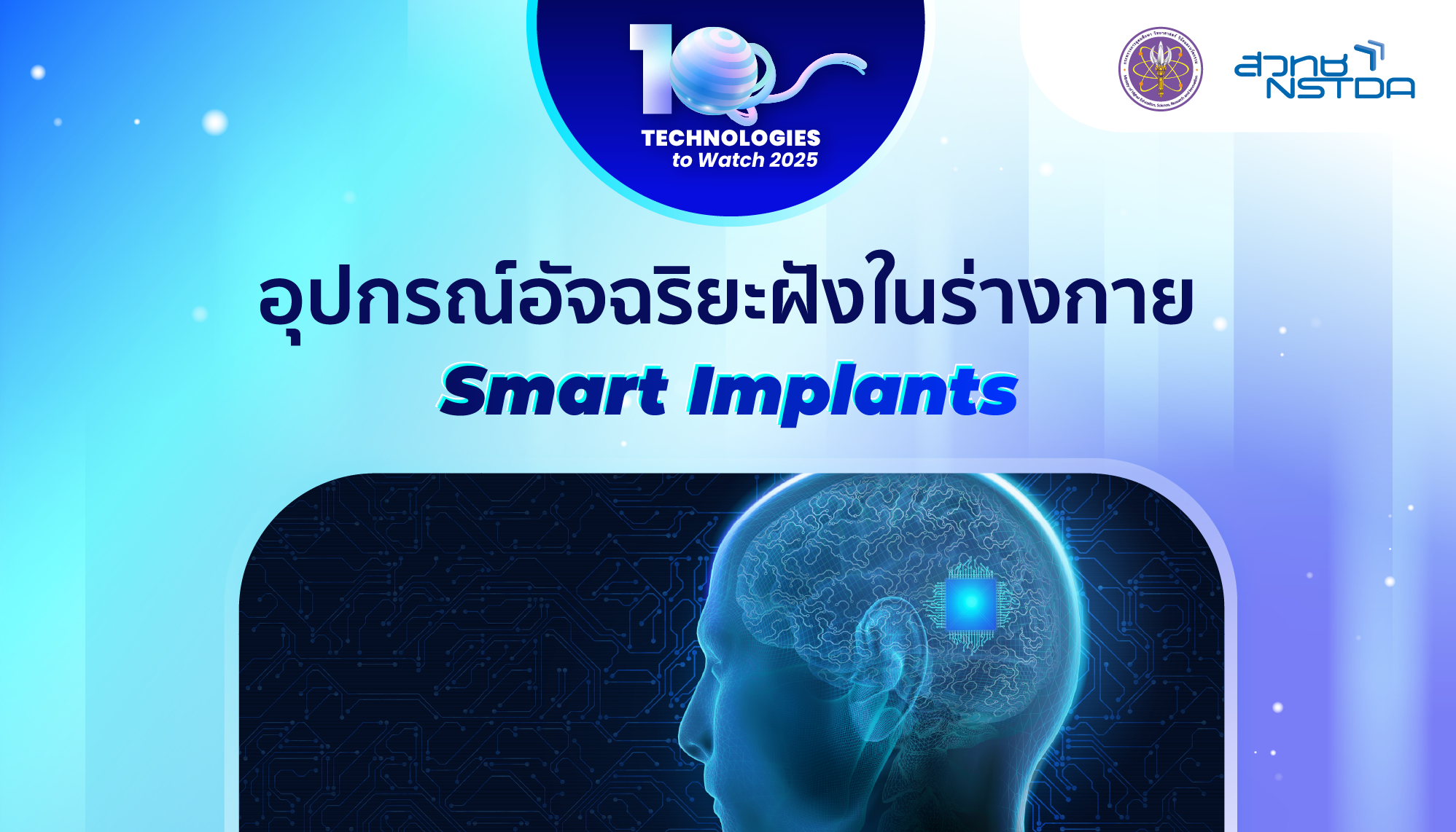 10 Technologies to Watch 2025: อุปกรณ์อัจฉริยะฝังในร่างกาย (Smart Implants)