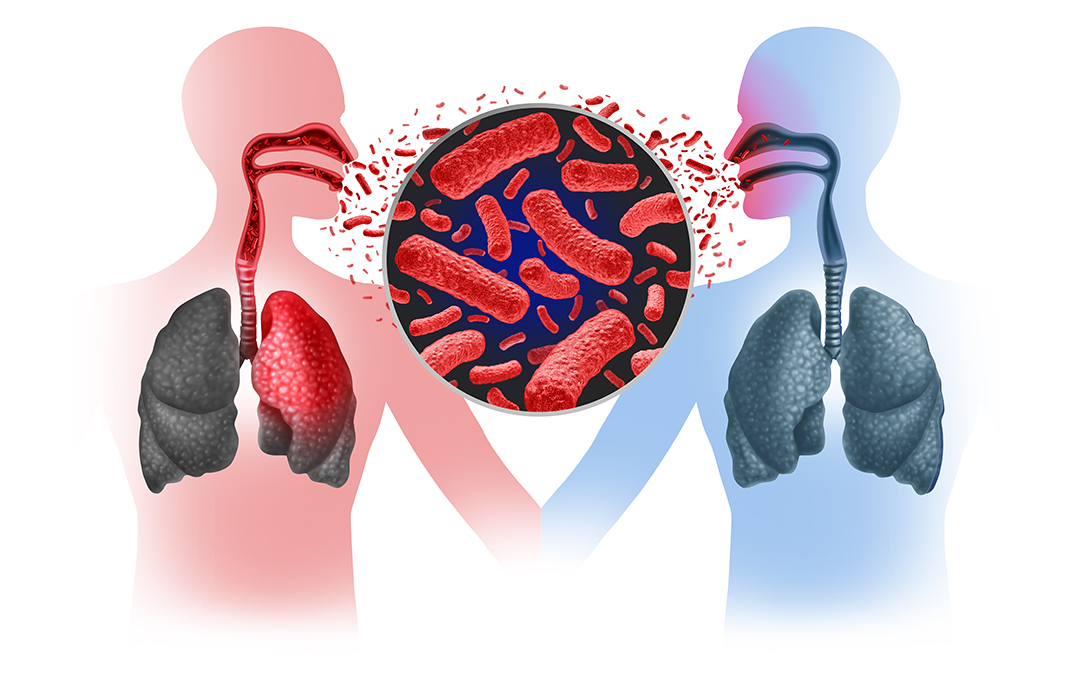 การแพร่กระจายของโรควัณโรคจากคนสู่คน