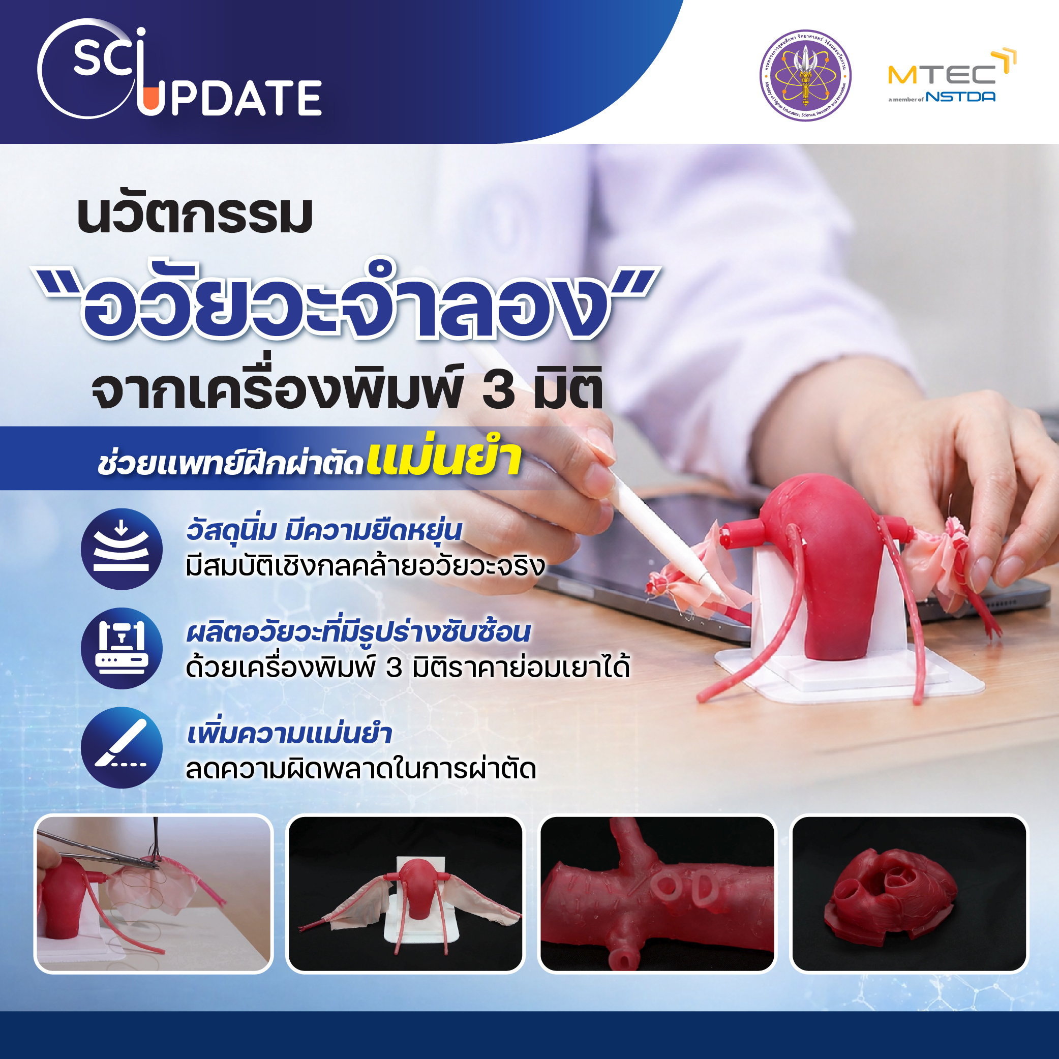 นวัตกรรม “อวัยวะจำลอง” จากเครื่องพิมพ์ 3 มิติ ช่วยแพทย์ฝึกผ่าตัดแม่นยำ