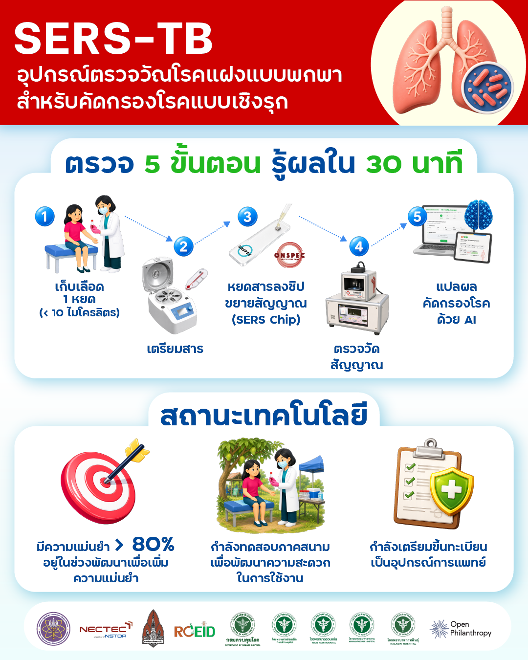อินโฟกราฟิก SERS-TB แสดงขั้นตอนการตรวจคัดกรองวัณโรคแฝง 5 ขั้นตอน ตั้งแต่เก็บเลือดจนถึงการวิเคราะห์ผลด้วย AI ภายใน 30 นาที