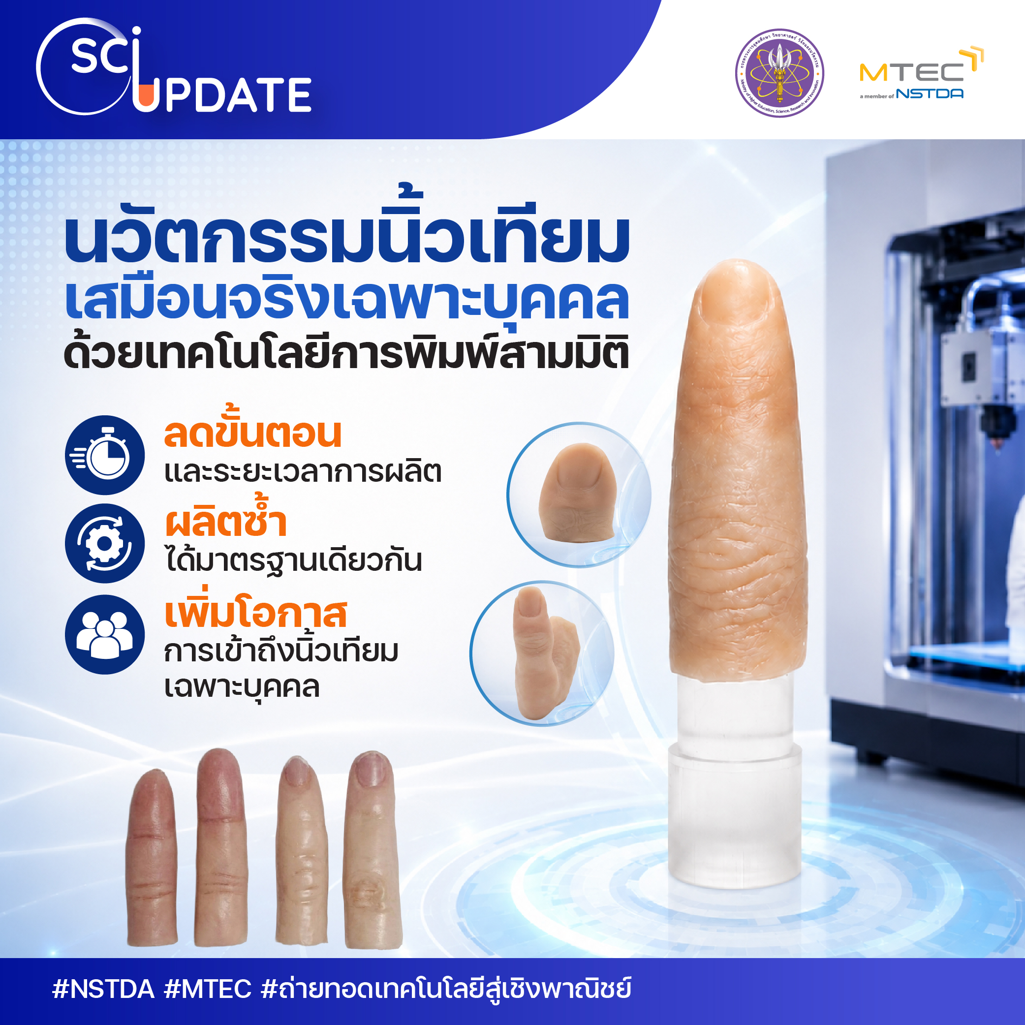 “นิ้วเทียมเสมือนจริง” ฝีมือนักวิจัยไทย พลิกโฉมการผลิตอวัยวะเทียมเฉพาะบุคคลด้วยเทคโนโลยีการพิมพ์สามมิติ